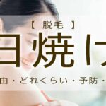 脱毛　日焼け